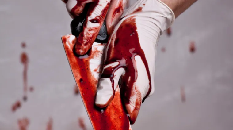 Ubio kirurga jer nije bio zadovoljan operacijom nosa!