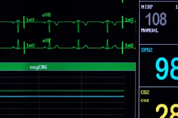 Ostojić potrošio 37 milijuna kuna na uređaje za umjetno disanje