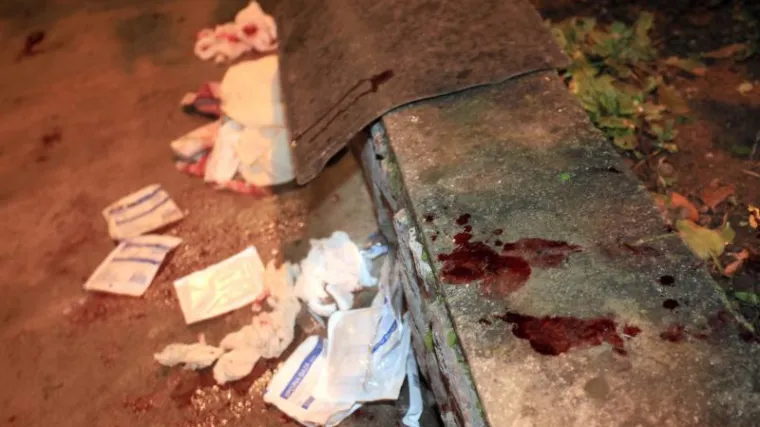 Podivljali psi izgrizli ženu u Kastvu!