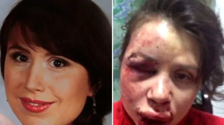 Brutalni napad na novinarku razbuktao prosvjede!