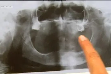 Čudesni ljudi i njihove šokantne priče