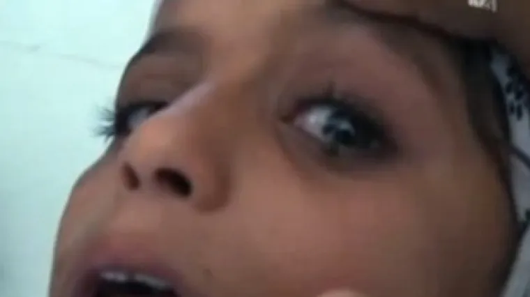 Iz njezinih očiju izlaze 'kamenčići'