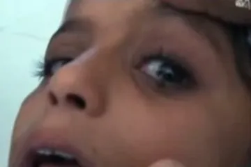 Iz njezinih očiju izlaze 'kamenčići'