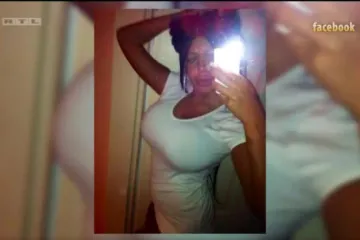 Djevojka iz Silikonske doline ekskluzivno o plastičnim operacijama