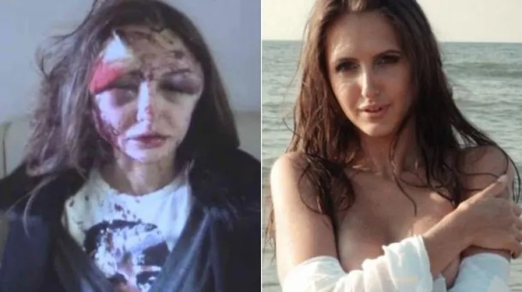 Odbjegli ruski milijunaš divljački prebio djevojku