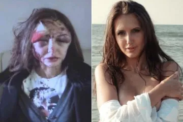 Odbjegli ruski milijunaš divljački prebio djevojku