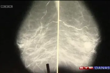 Jedan od krivaca za duge liste čekanja su - PACIJENTI!