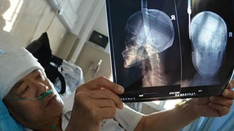 Pao mu nož posred glave dok je &scaron;etao, a on ga nije ni osjetio!