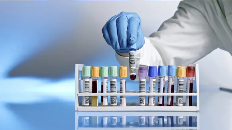 U bolnicama neprerađena krvna plazma!