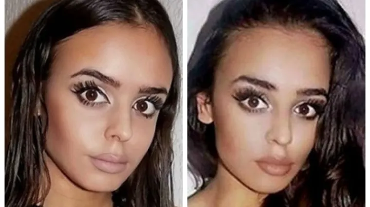 Razlog sukoba blizanki je nogometa&scaron;? Izbodena sestra pu&scaron;tena iz bolnice