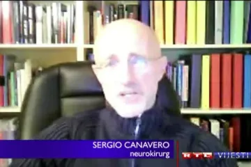 Prva transplantacija ljudske glave moguća već za dvije godine!