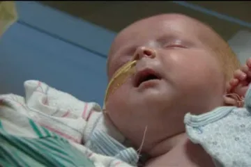 Najmlađi pacijent: bebi staroj samo šest dana transplantirali srce!