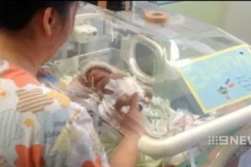 Beba koja je pobijedila smrt