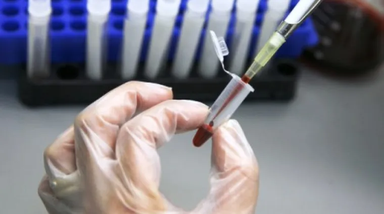 Veliko otkriće znanstvenika - cjepivo po mjeri svakog pacijenta!