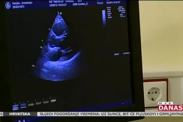 RTL istražio od čega Hrvati najviše umiru
