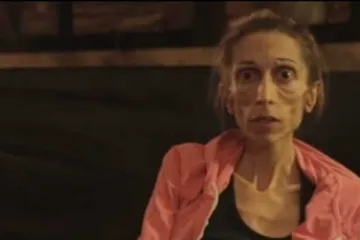 Rachel ozbiljno prijeti smrt zbog anoreksije a liječnici joj ne žele pomoći