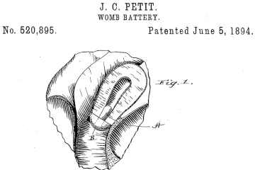 O moj Bože, električni dildo iz 1894.
