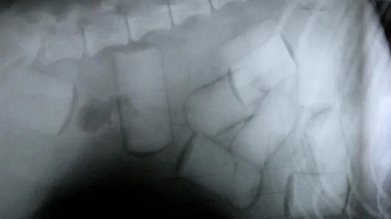 Progutao 59 kapsula kokaina: policija u zračnoj luci uhitila krijumčara droge