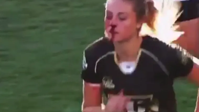 Ova ragbija&scaron;ica je grublja nego &scaron;to će ikad itko biti: sa slomljenim nosom oborila dvije suparnice