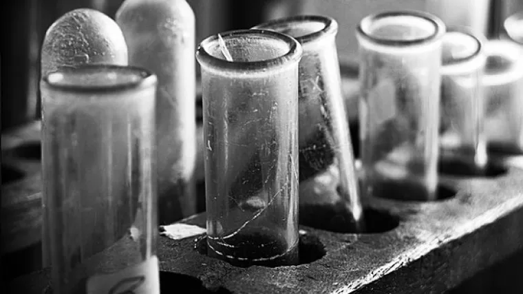 Pronađeni uzorci tkiva Židova ubijenih zbog medicinskih eksperimenata