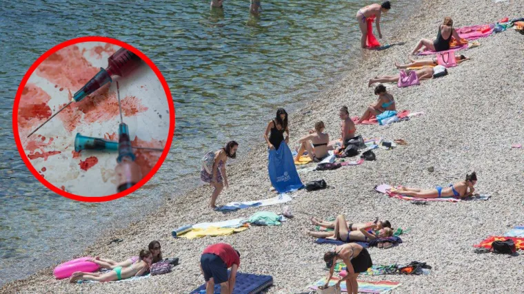 Riječka plaža na kojoj se kupaju obitelji s djecom puna krvavih igala!