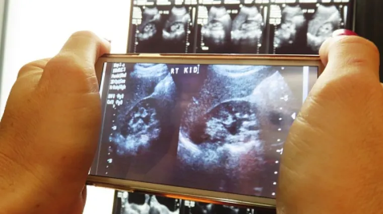 Policija istražuje slučaj čovjeka koji je oglasio prodaju bubrega: sa 50.000 eura htio se spasiti ovrhe na kuću