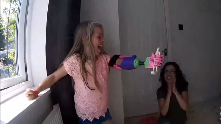 Djevojčica presretna nakon što je dobila protezu iz 3D printera