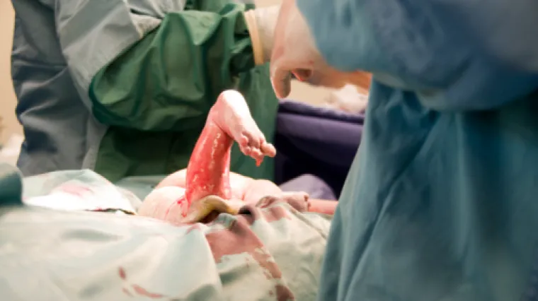 Stravična smrt žene na porodu: liječnici otkinuli bebi glavu i ostavili je u majčinoj utrobi