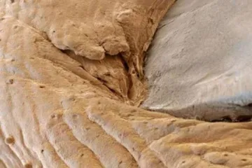 Fascinantne slike ljudskog tijela pod mikroskopom kao da su ispale iz horora