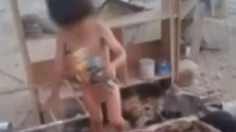 Trudna kujica dojila pothranjenog dvogodi&scaron;njaka, dječak izbjegao sigurnu smrt