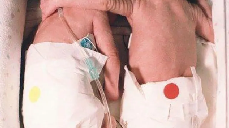 Kada je ova beba zagrlila umiruću sestru blizanku, nitko nije očekivao čudo!