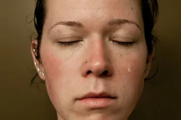 Autoportretima otkrila svu patnju i bol drastičnog mršavljenja