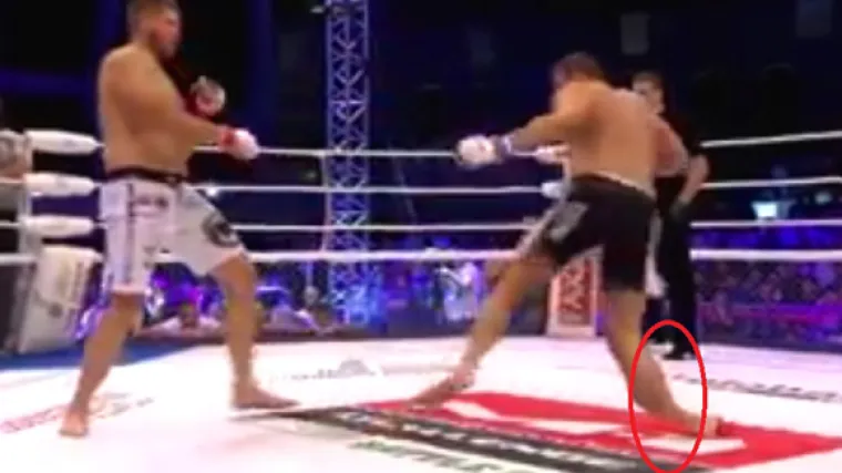 Uznemirujuća snimka: hrvatski borac pao nakon &scaron;to mu je protivnik slomio nogu usred borbe