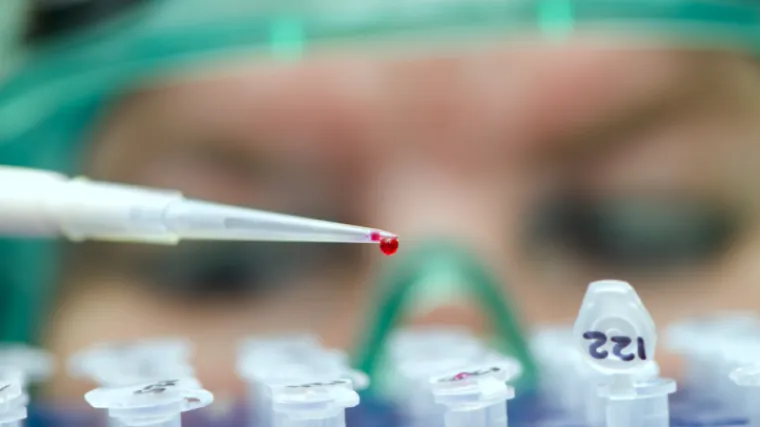 SAD &scaron;alje 300 milijuna dolara u Afriku u svrhu suzbijanja &scaron;irenja zaraze HIV-om