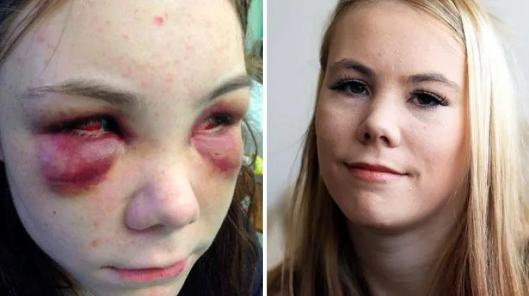 Osuđeni zbog divljačkog iživljavanja nad maloljetnicom