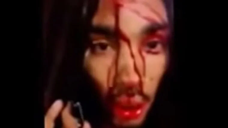 Reperu pucali u glavu, a on izvadio mobitel i snimio video