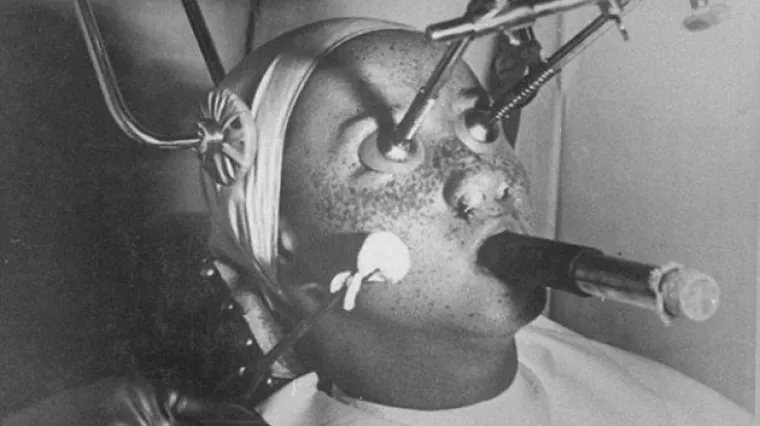 Bizarne beauty naprave s početka 20. stoljeća