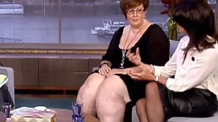 Zbog bolesti "te&scaron;kih nogu" ne može potrčati za svojim sinom