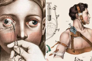Medicina se učila iz ovih jezivih ilustracija...