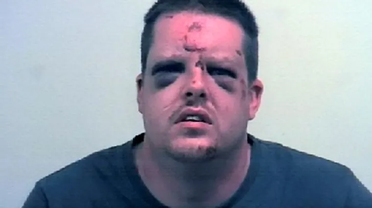 Ovako to izgleda kada hrabra žena odluči uzvratiti silovatelju!