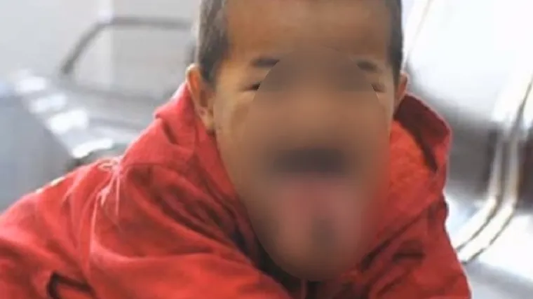 Zbog tumora ne može jesti ni govoriti