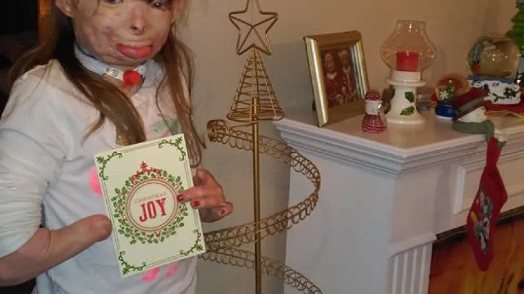 Ova curica izgubila je cijelu obitelj u požaru, a sada ima samo jednu jednostavnu božićnu želju