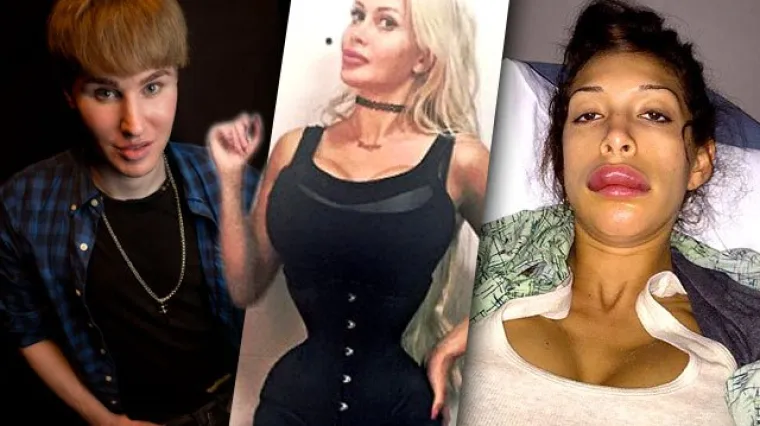 Od lijepih žena do monstruma: naj&scaron;okantnije plastične operacije u 2015.