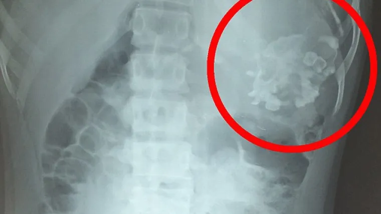 Nitko ne bi htio ovako &scaron;to u želucu