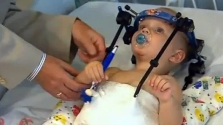 Bebi spojili otkinutu glavu, tinejdžeru smanjili penis, vatrogascu presadili lice