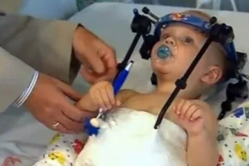 Bebi spojili otkinutu glavu, tinejdžeru smanjili penis, vatrogascu presadili lice