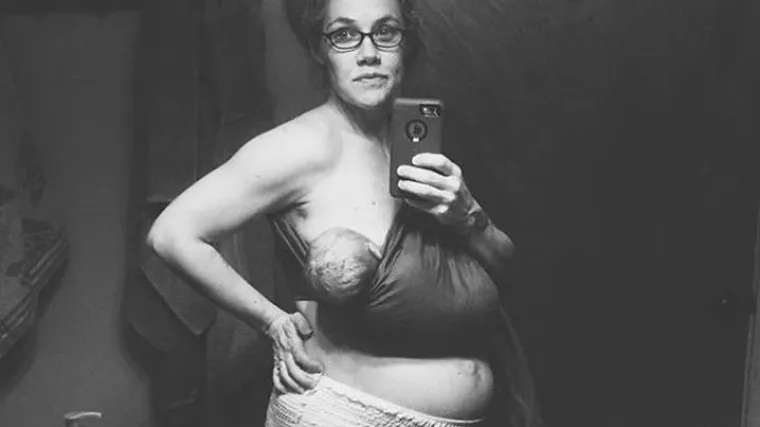 Nova majka napravila selfije i pokazala kako žena izgleda nakon poroda