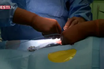 U Poljskoj ugrađen najmanji pejsmejker na svijetu