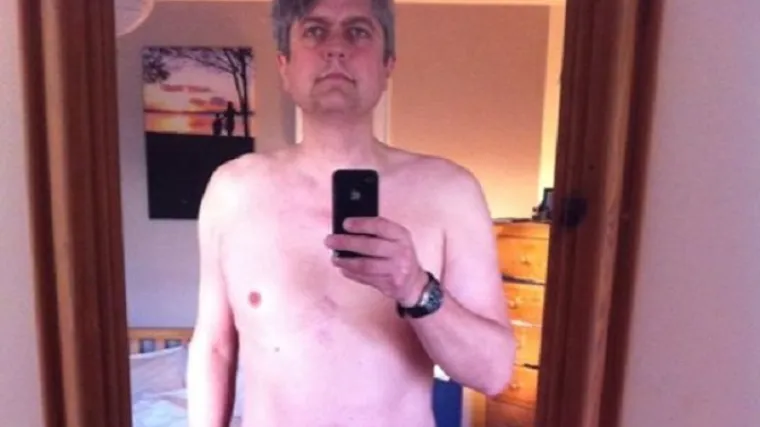 Surovom fotografijom upozorio na rak prostate