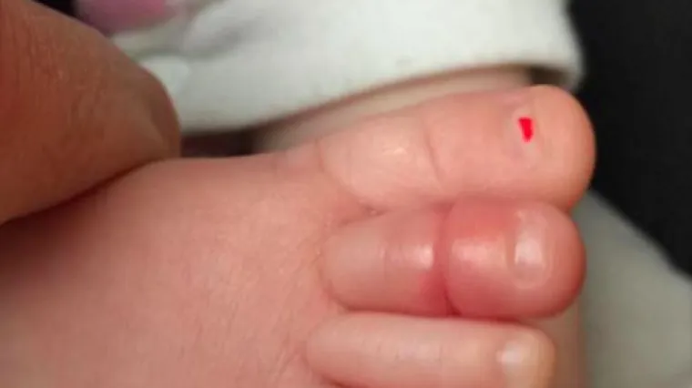 Na&scaron;a beba je skoro ostala bez prstića, a može se dogoditi ba&scaron; svakome